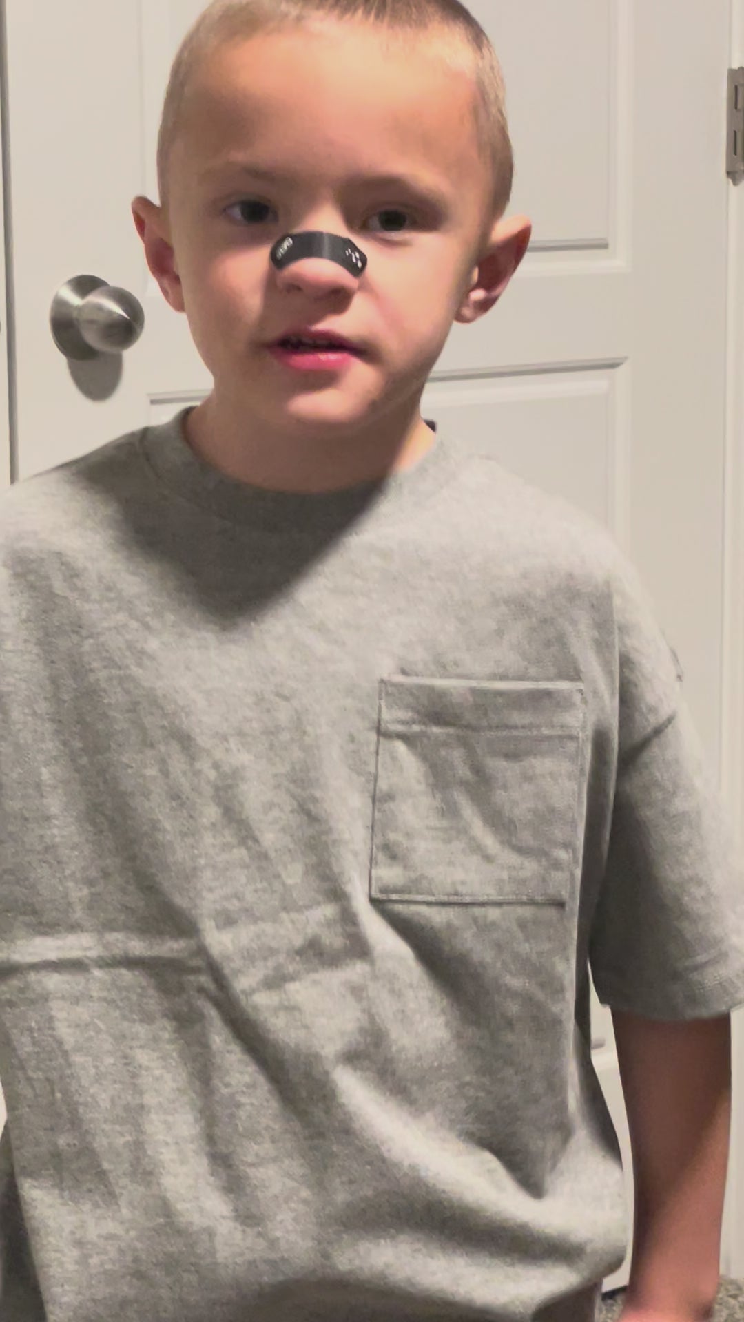 Load video: SLYD NASAL STRIPS (35 PACK) SMALL (Kids Size)